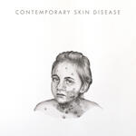 Skin disease